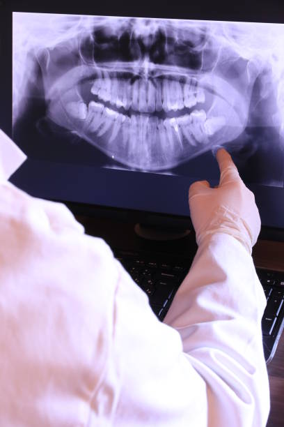Best Emergency Tooth Extraction in Wallingford Center, CT