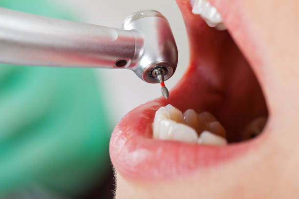 Best Walk-In Emergency Dentist in Wallingford Center, CT